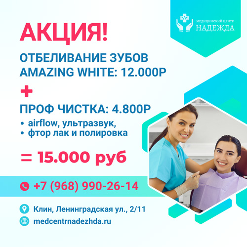 otbelivanie chistka
